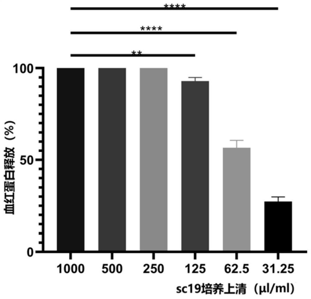 Application of ellipticine hydrochloride in preparation of anti-streptococcus suis hemolysin drug