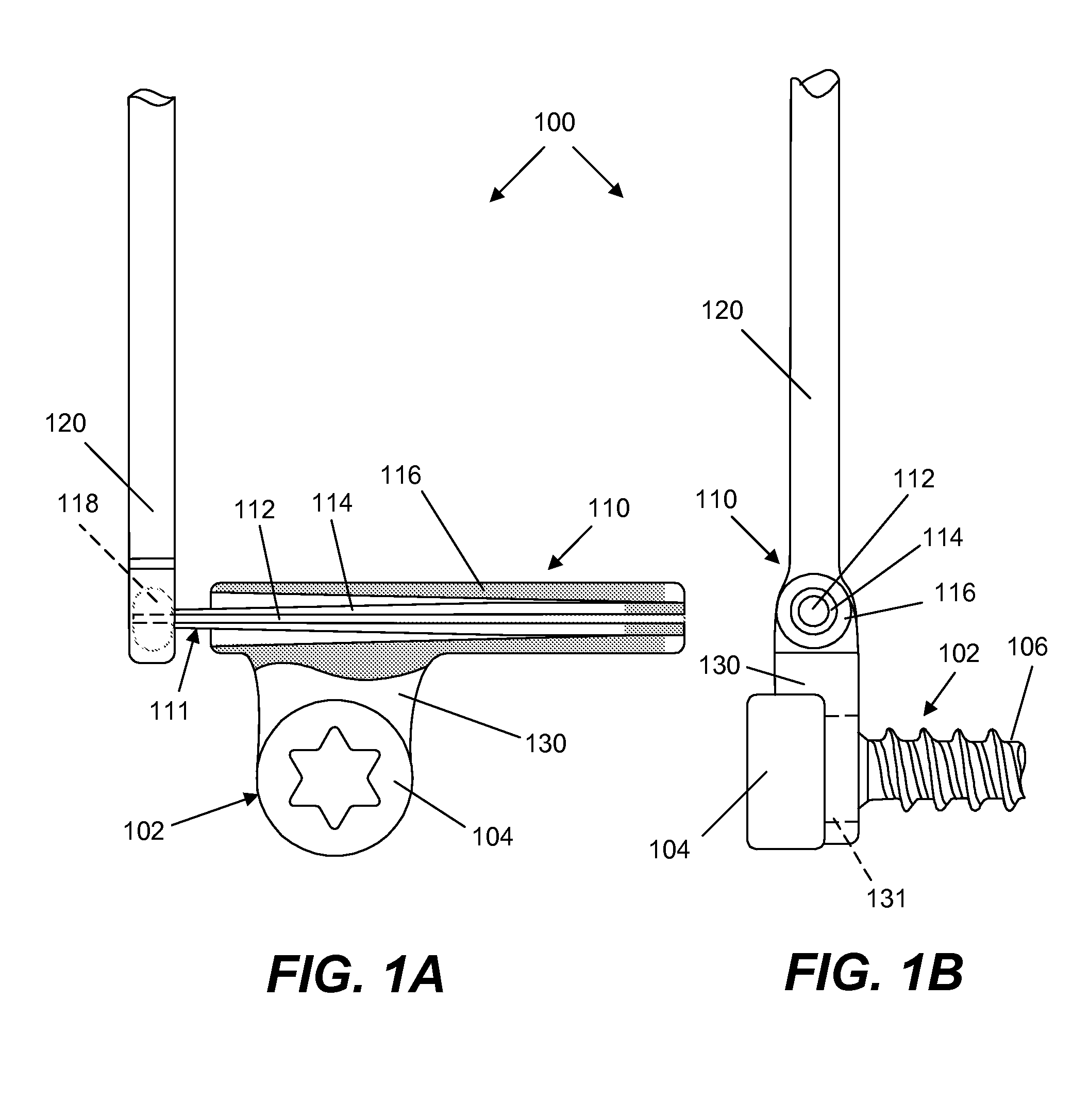 Spine implant with a defelction rod system anchored to a bone anchor and method