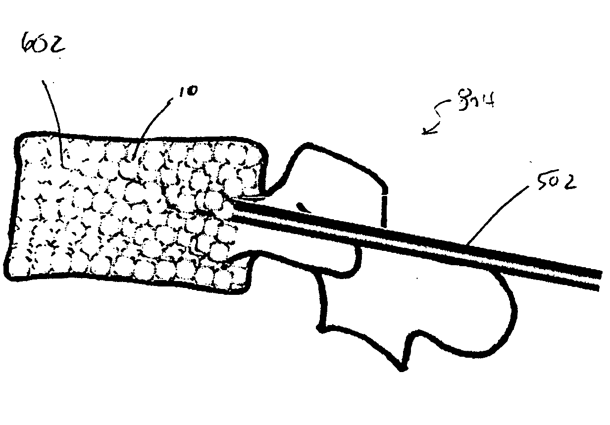 Method and apparatus for filling a cavity