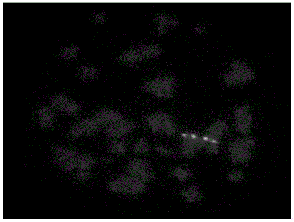 ALK gene and EML4 gene detection probe, preparing method thereof and kit