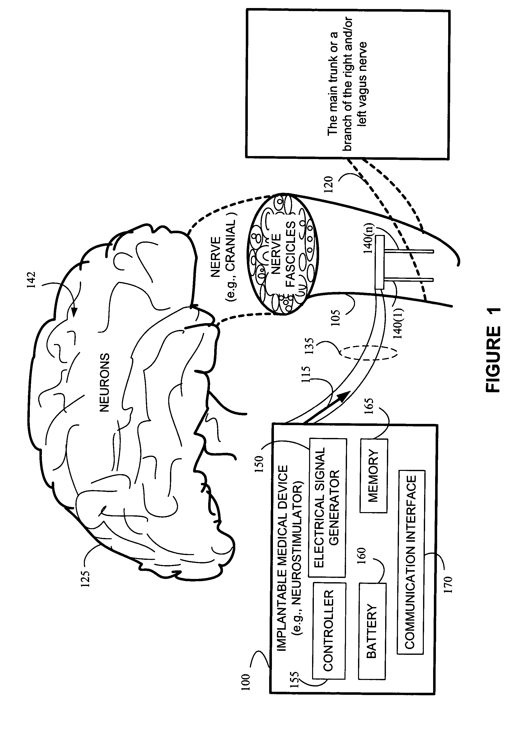 Treatment of reproductive endocrine disorders by vagus nerve stimulation