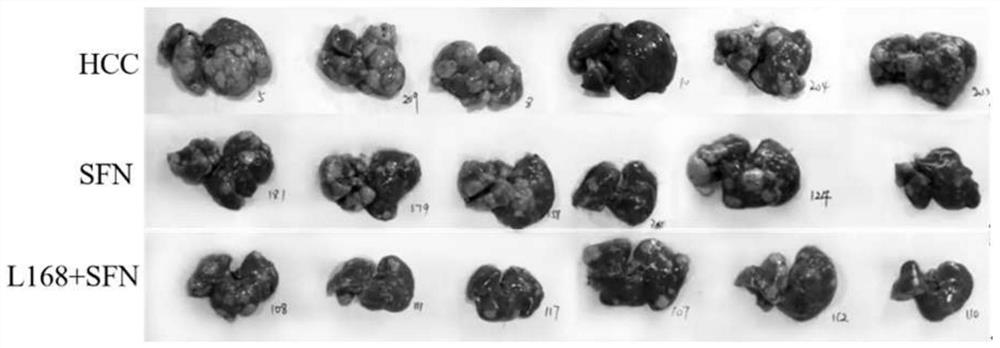 Application of lactobacillus plantarum L168 in assisting sorafenib in treating liver cancer