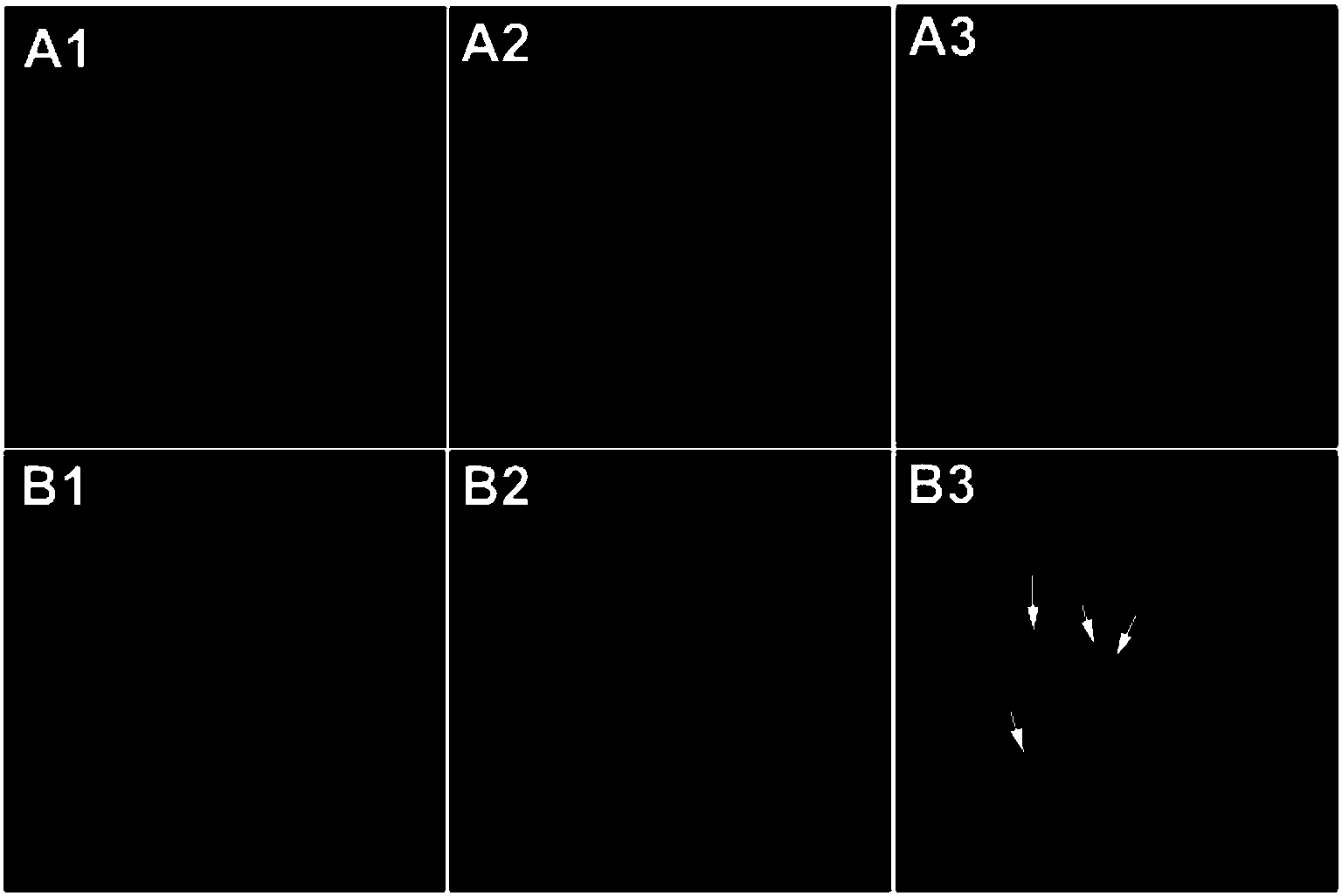 Use of lysine-specific demethylase 1 (LSD1) inhibitor