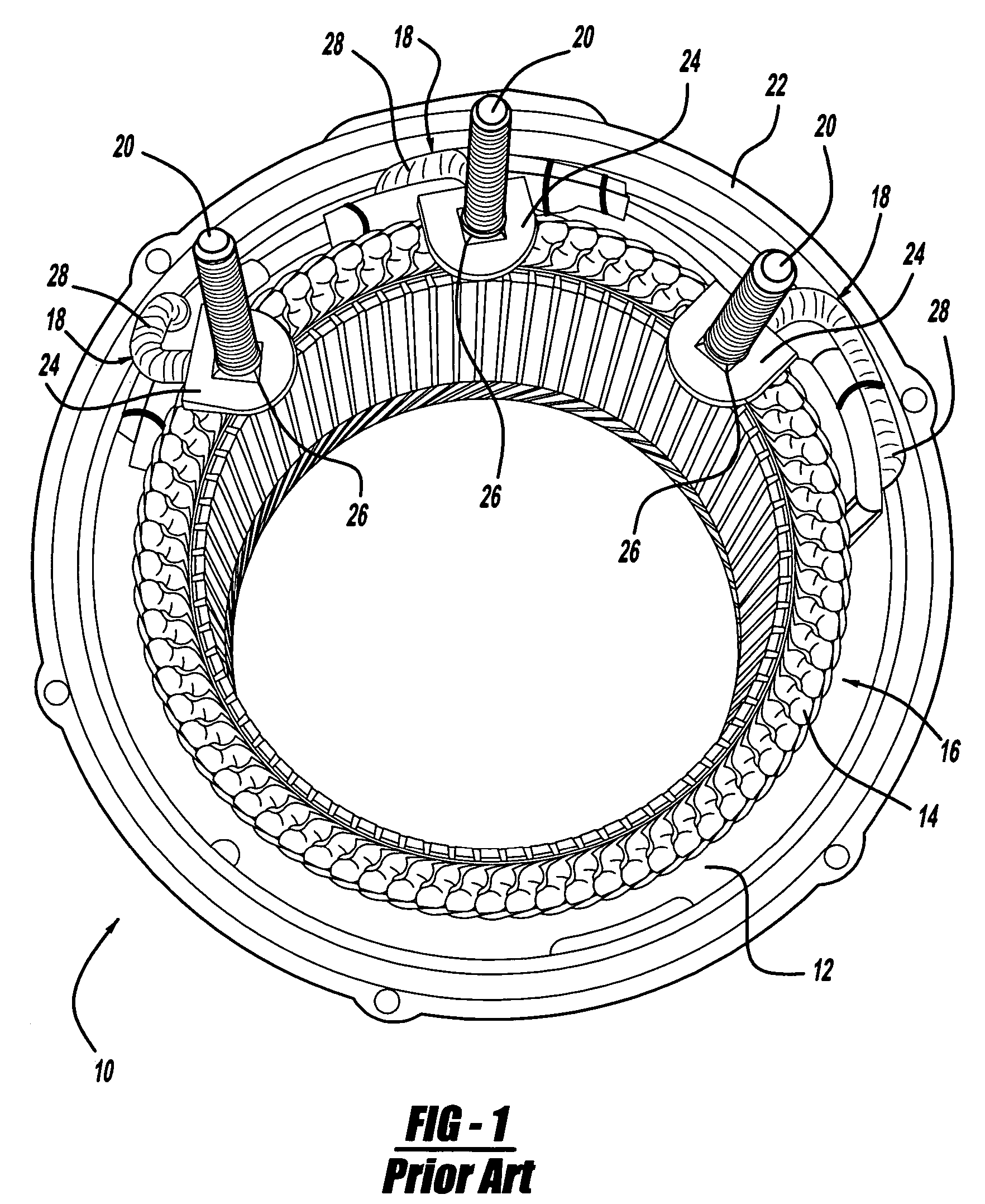 50 DN alternator stator terminal insulator apparatus