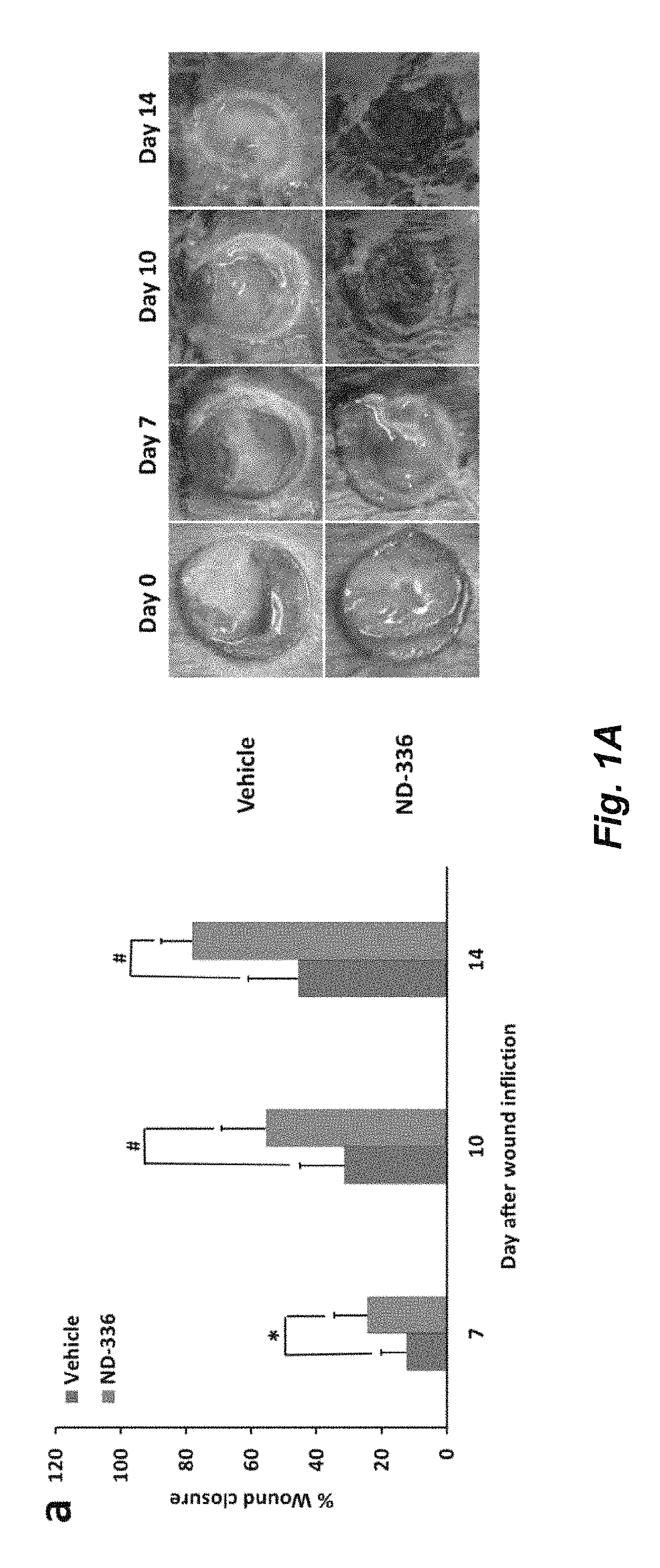 Acceleration of diabetic wound healing