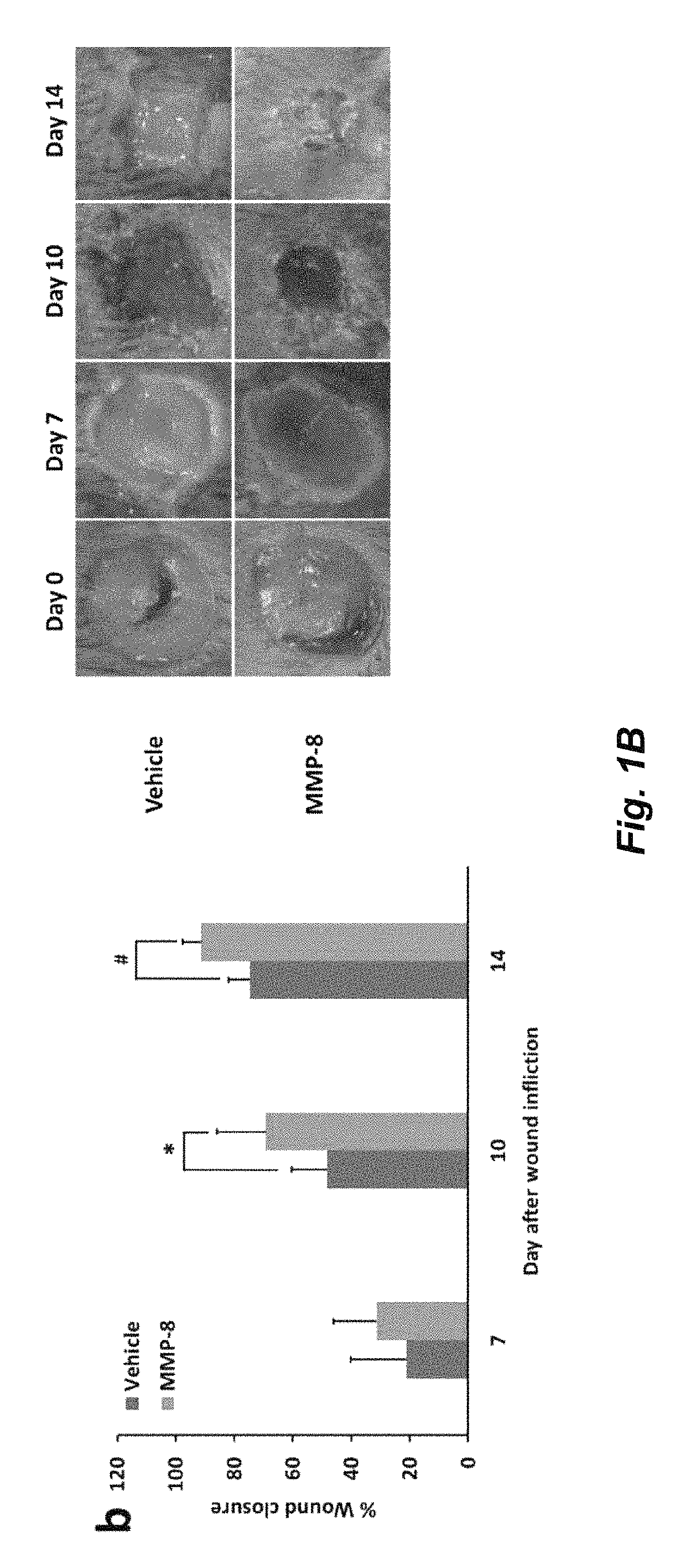 Acceleration of diabetic wound healing