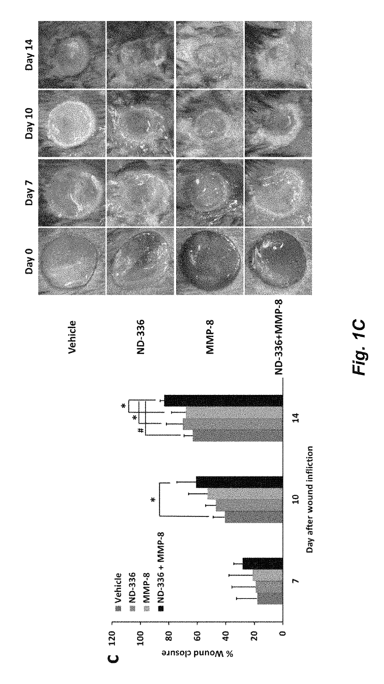 Acceleration of diabetic wound healing