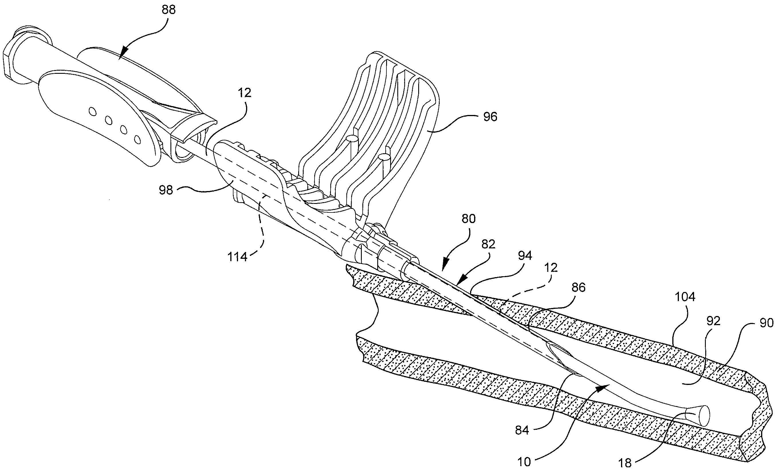 Conical diffuser tip