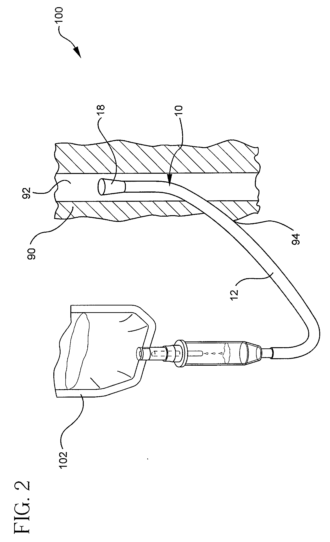 Conical diffuser tip