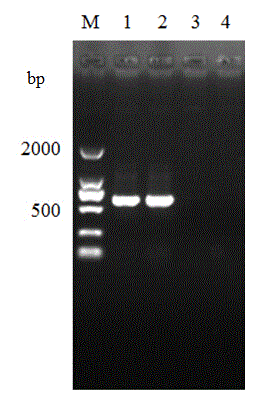 Application of septin1 gene to detection of nosema bombycis