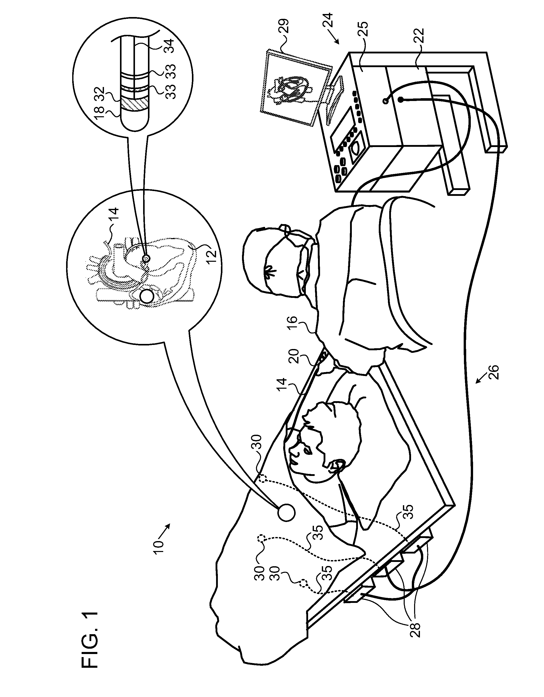 Integrative atrial fibrillation ablation