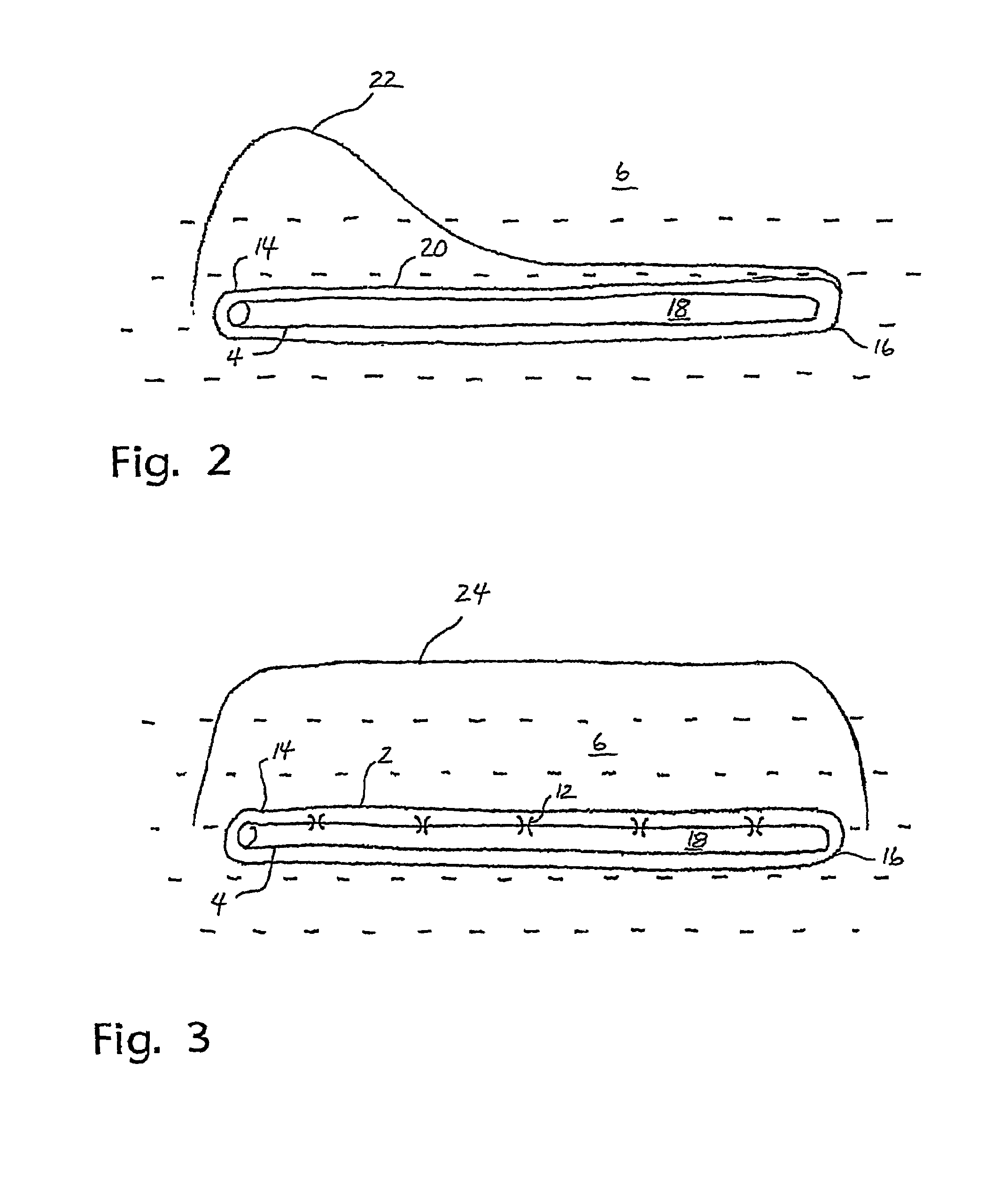 Flow control device for an injection pipe string