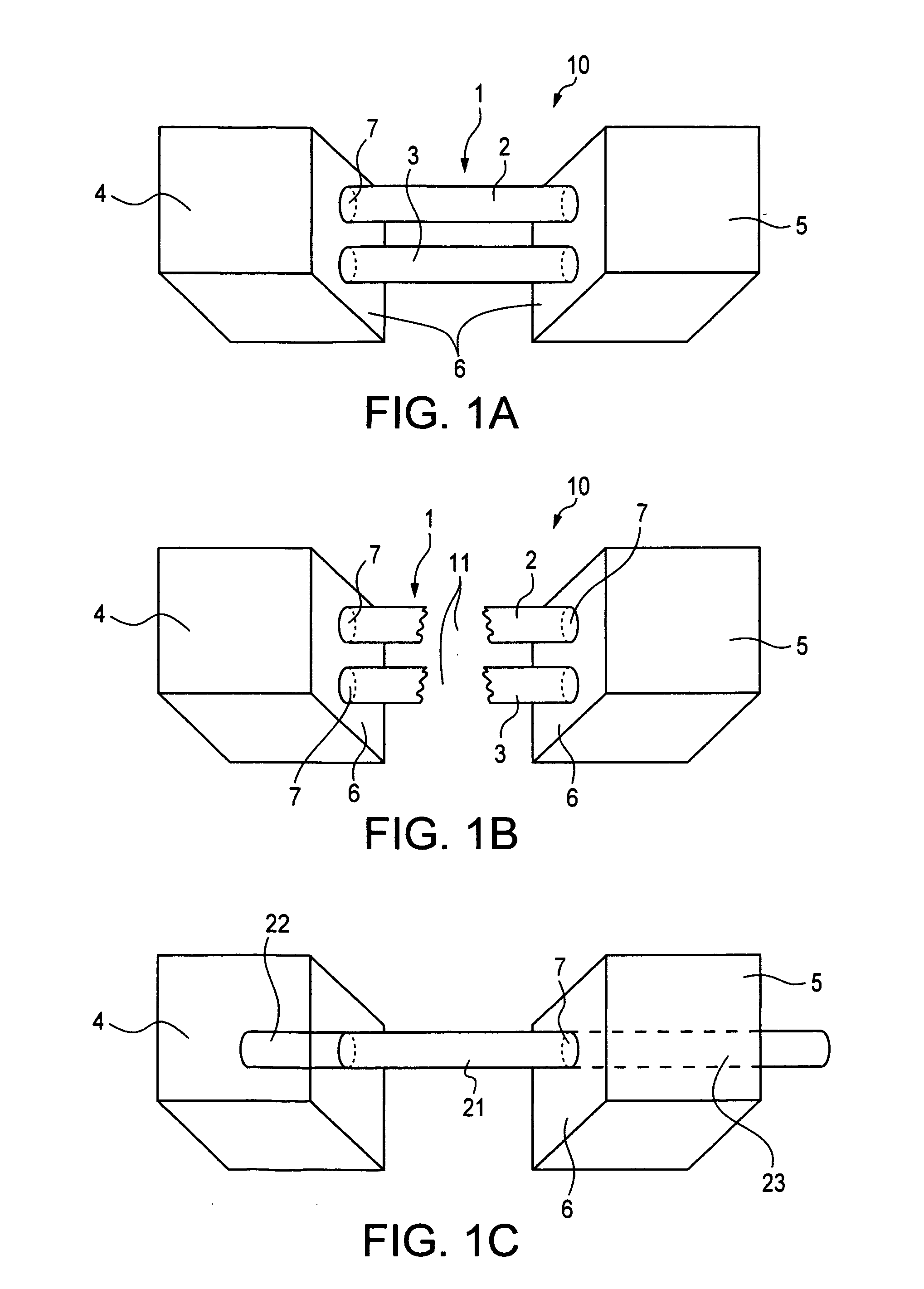 Cortical loop fixation system for ligament and bone reconstruction