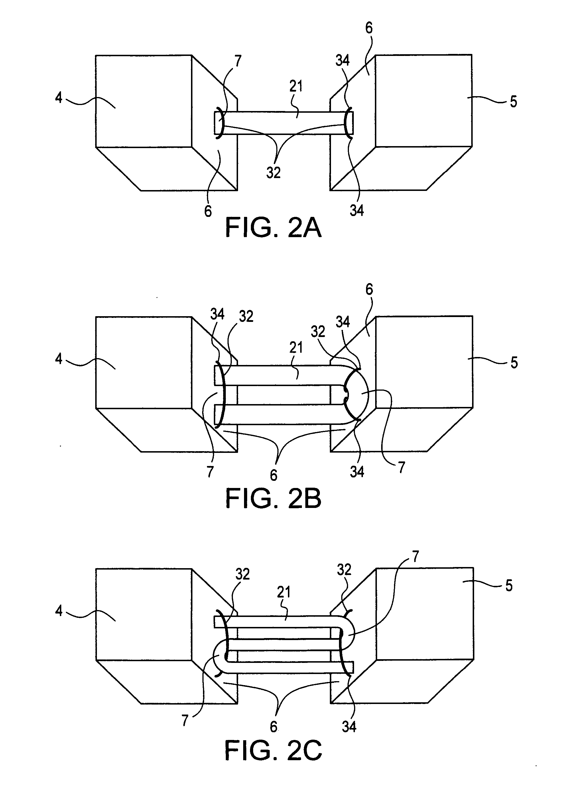 Cortical loop fixation system for ligament and bone reconstruction