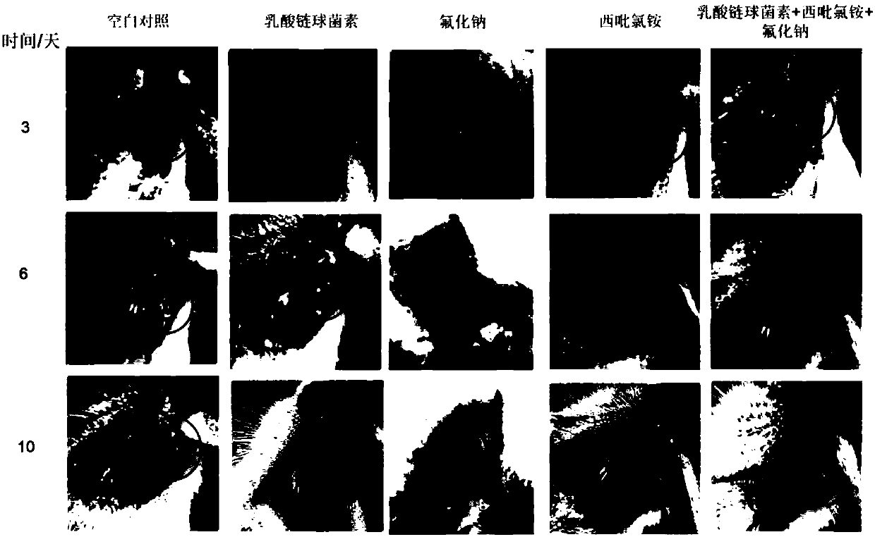 Preparation and application of nisin, cetylpyridinium chloride and sodium fluoride mouthwash