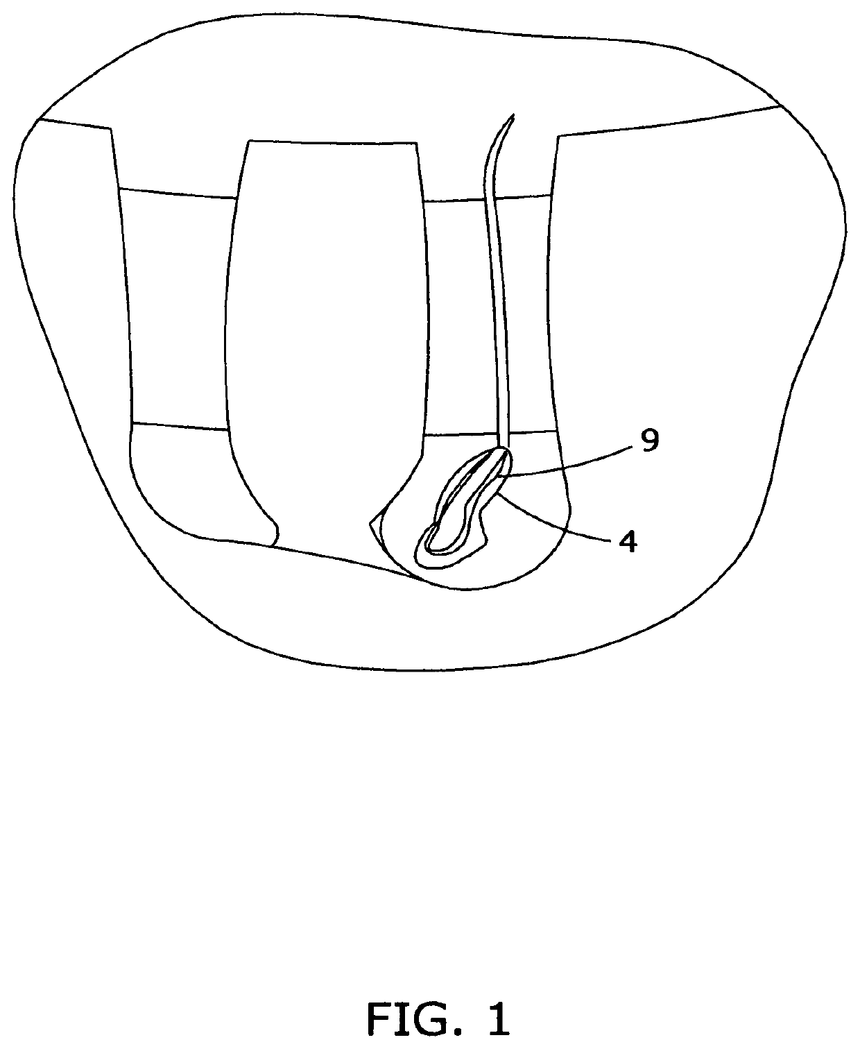 Devices and methods for quickly removing unwanted water from tanks