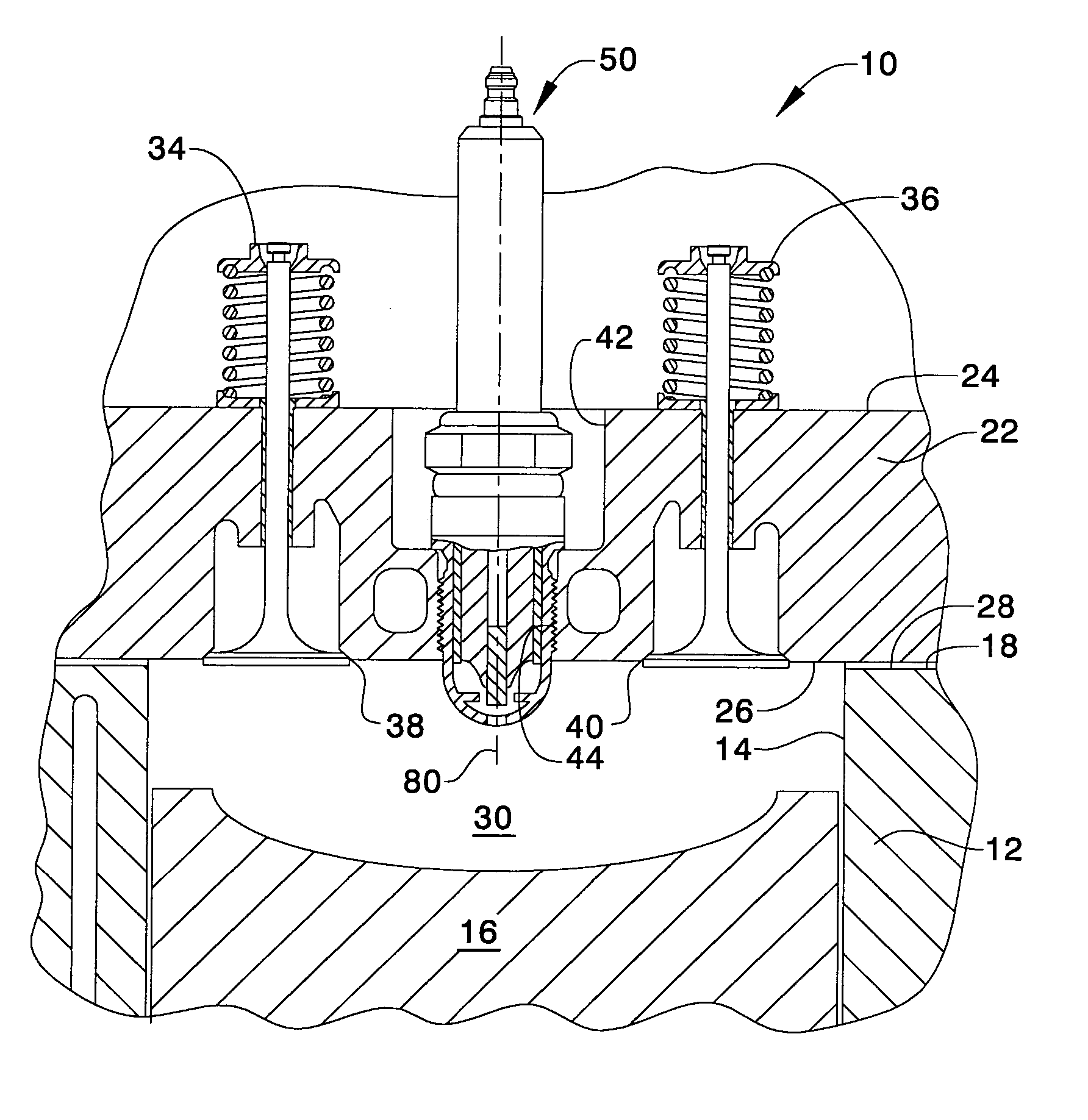 Pre-chambered type spark plug with pre-chamber entirely below a bottom surface of a cylinder head