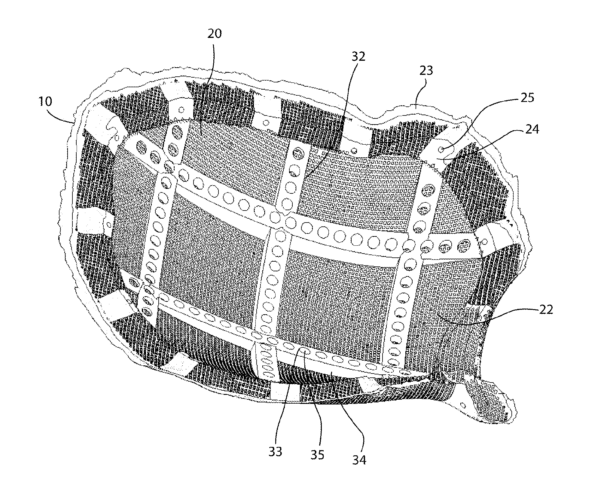 Reinforced biocompatible ceramic implant and manufacturing method thereof