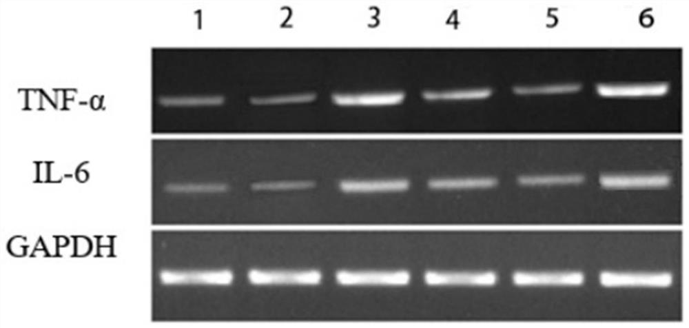 Fat component of inflammatory bowel disease formula food for special medical purpose and preparation method thereof