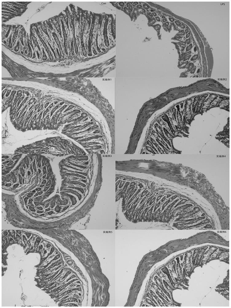 Fat component of inflammatory bowel disease formula food for special medical purpose and preparation method thereof