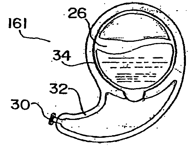 Packaging for disposable soft contact lenses