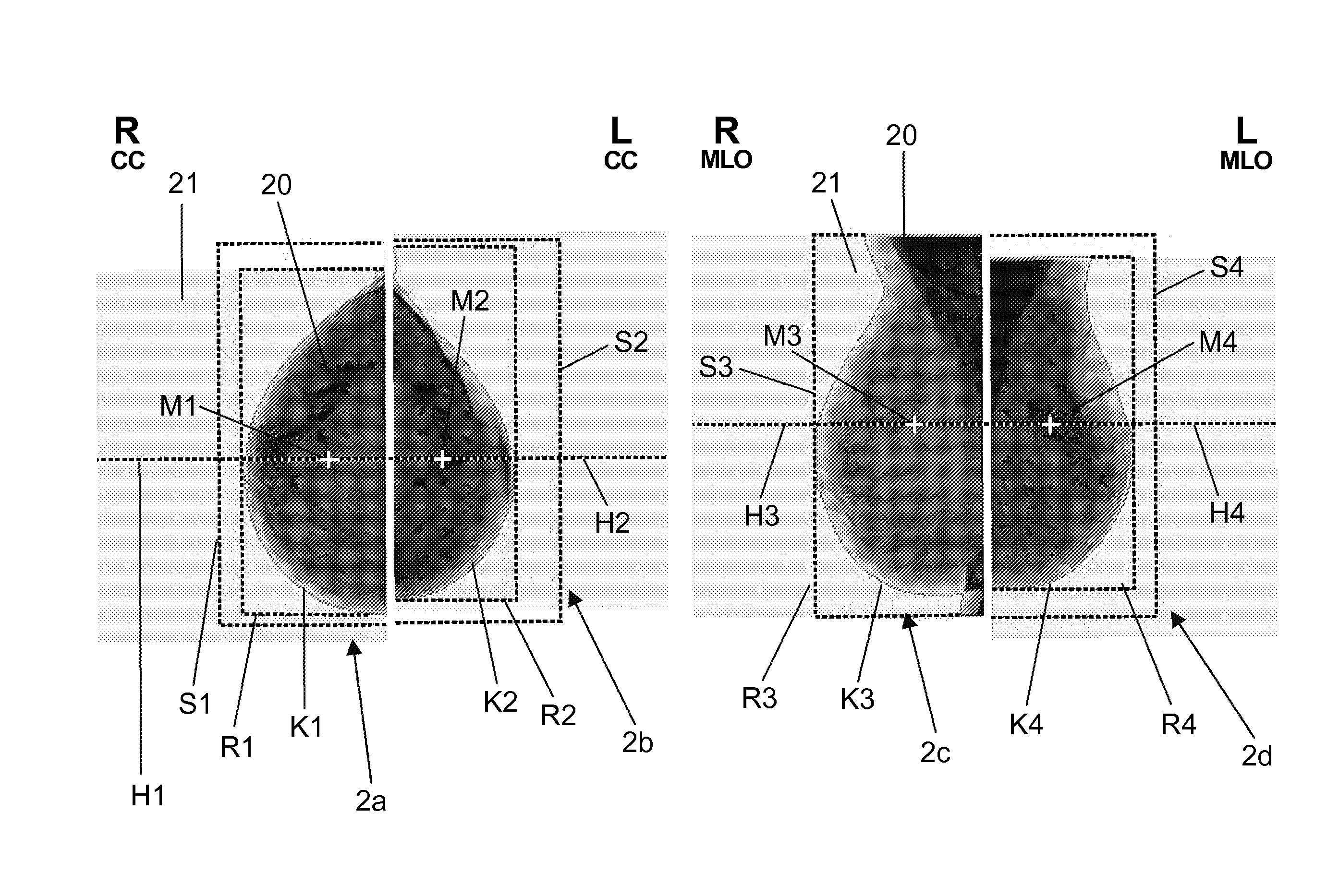 Method for processing findings entered in a mammogram