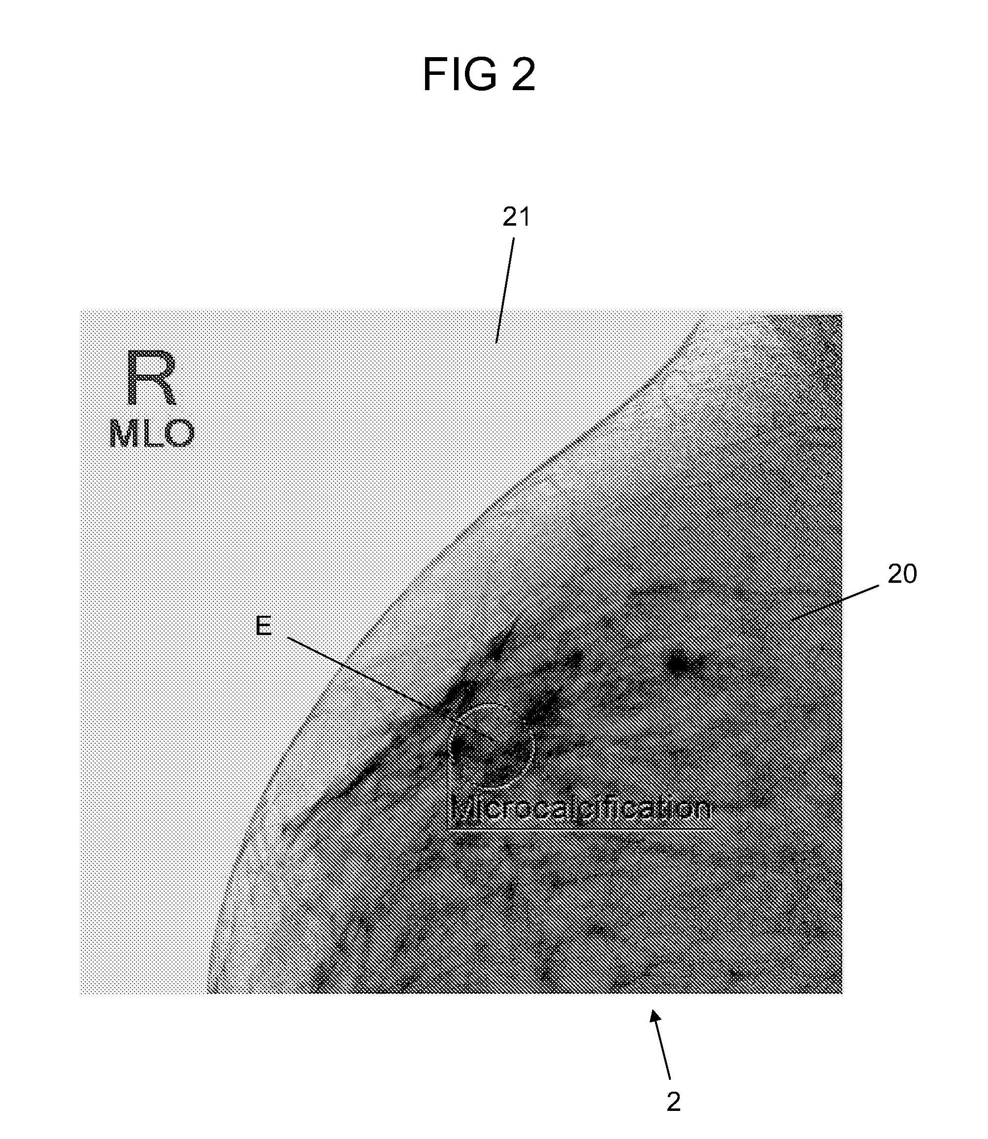 Method for processing findings entered in a mammogram