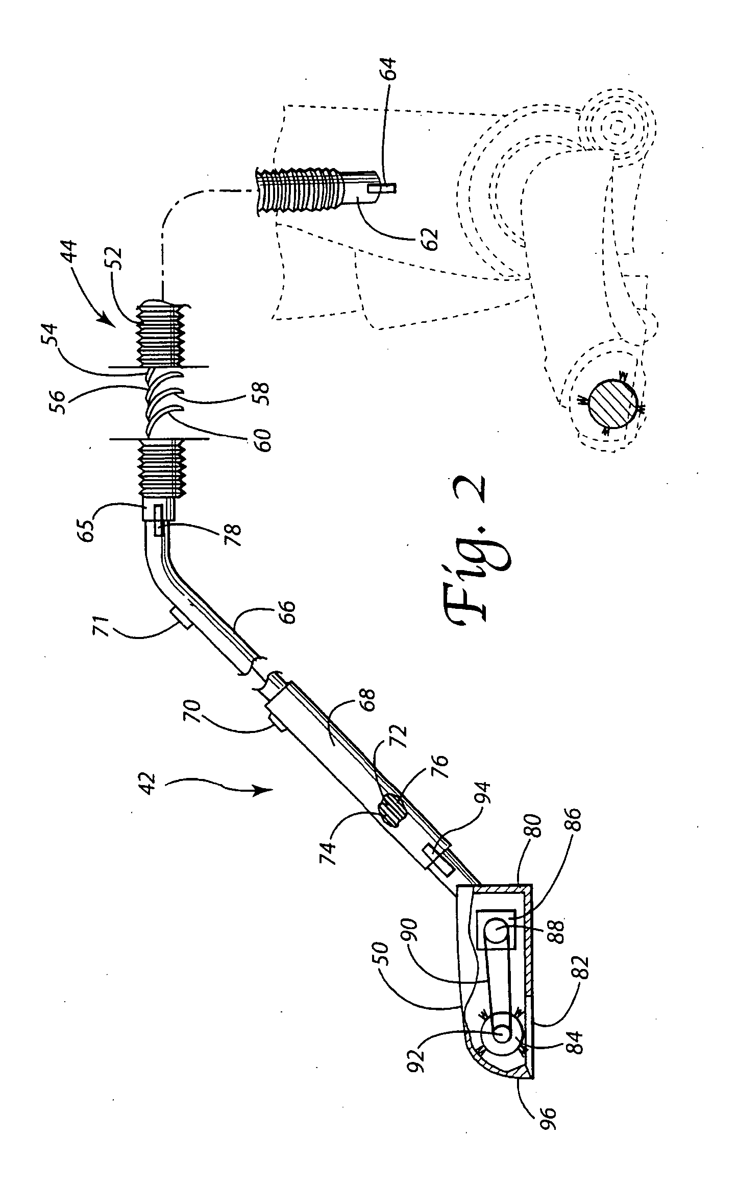 Upright vacuum cleaner equipped with electrified stretch hose and wand