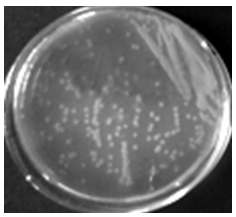 Acinetobacter with authigenic nitrogen fixation capacity and application thereof