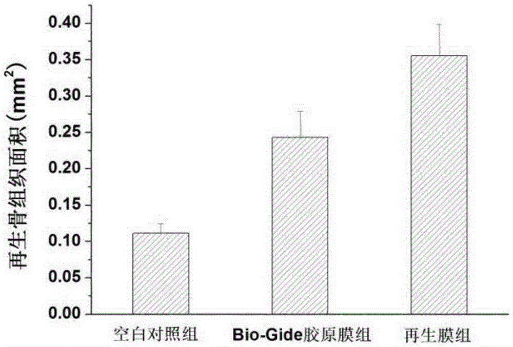 Biomembrane for guided tissue regeneration of periodontium, and preparation method and application thereof