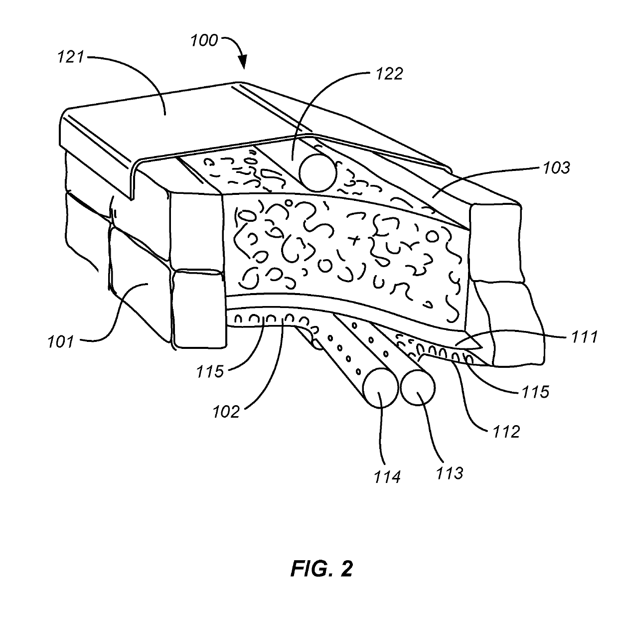 Composting system and method