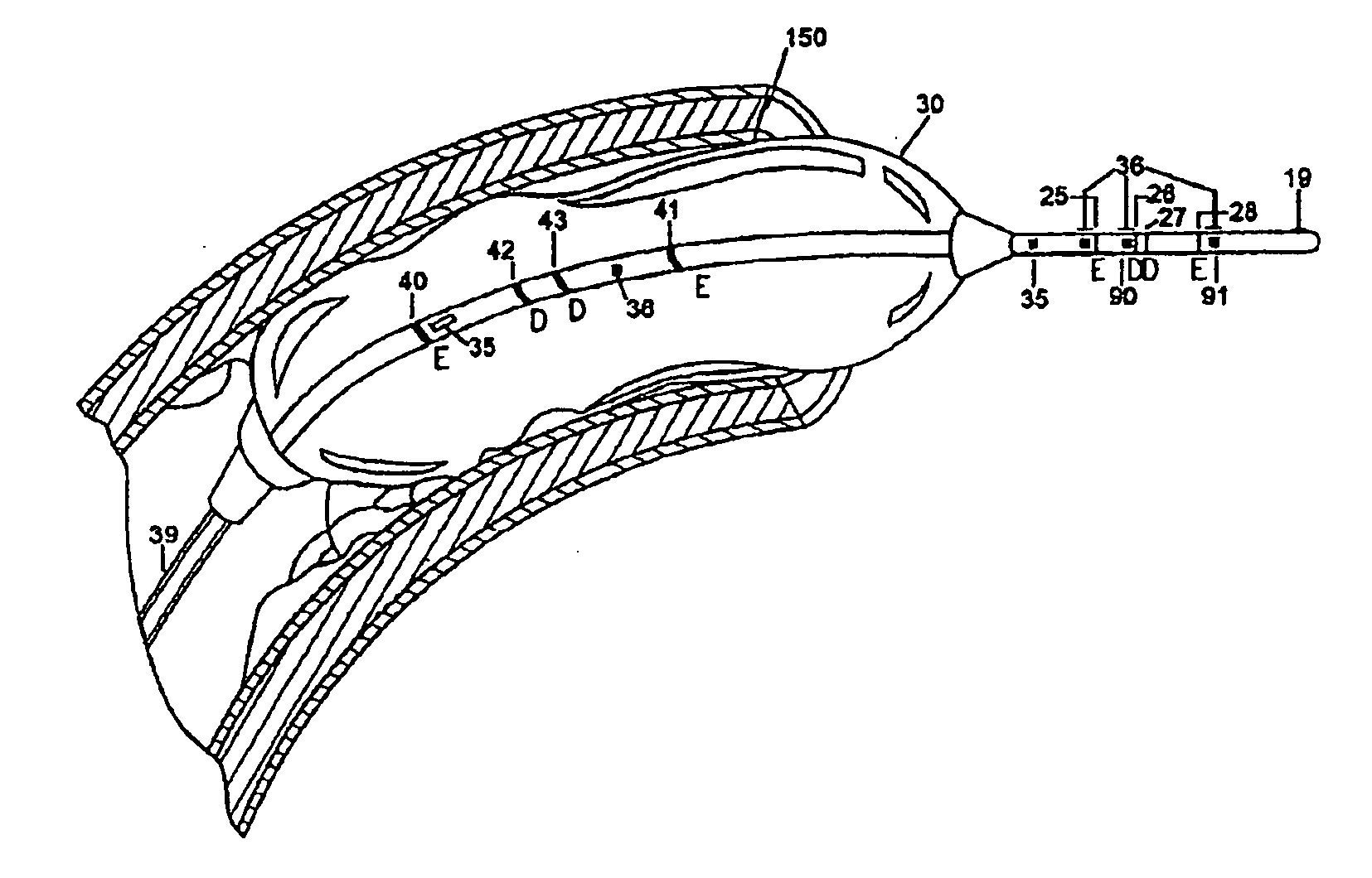 Systems and methods for epicardial navigation