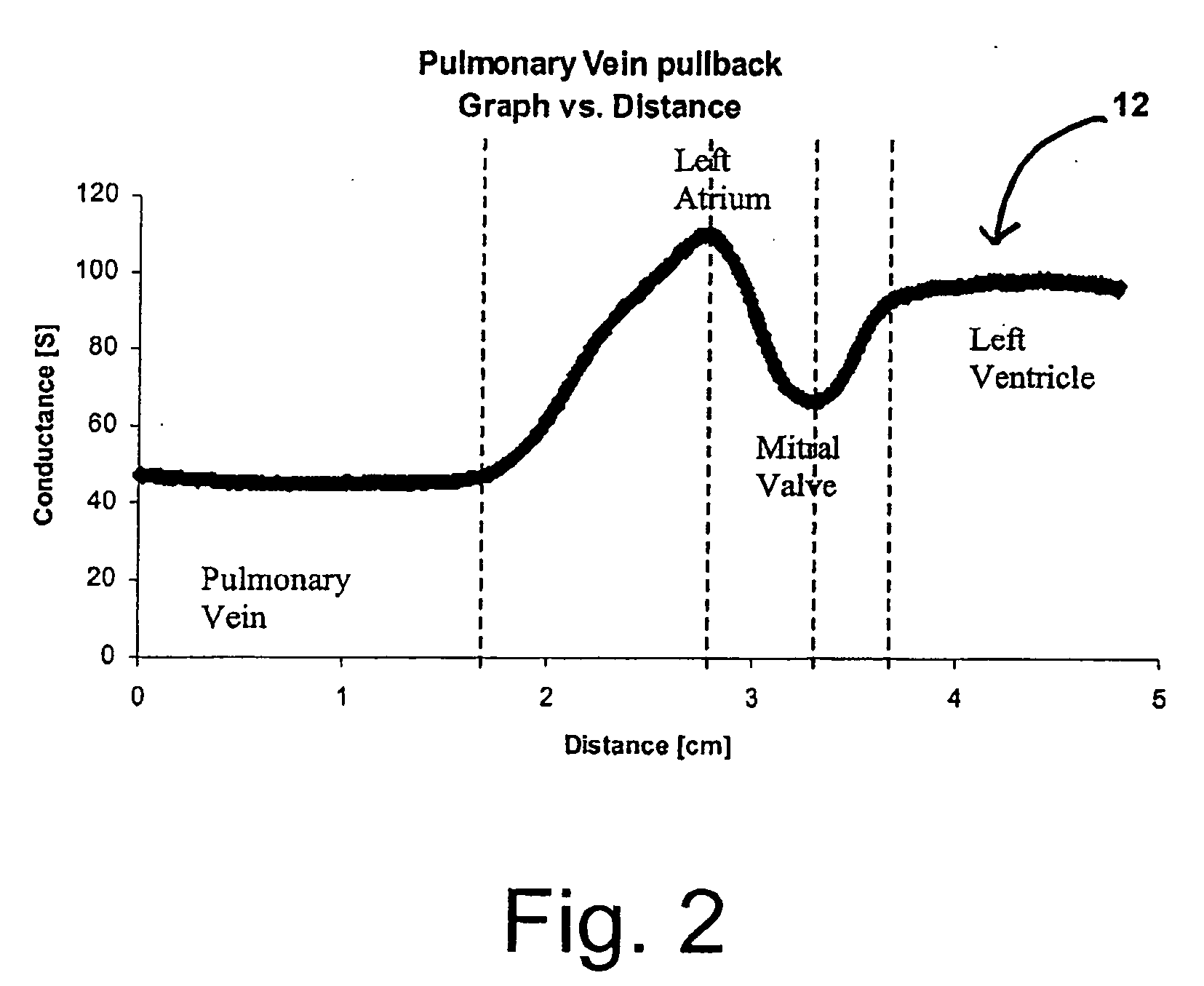 Systems and methods for epicardial navigation