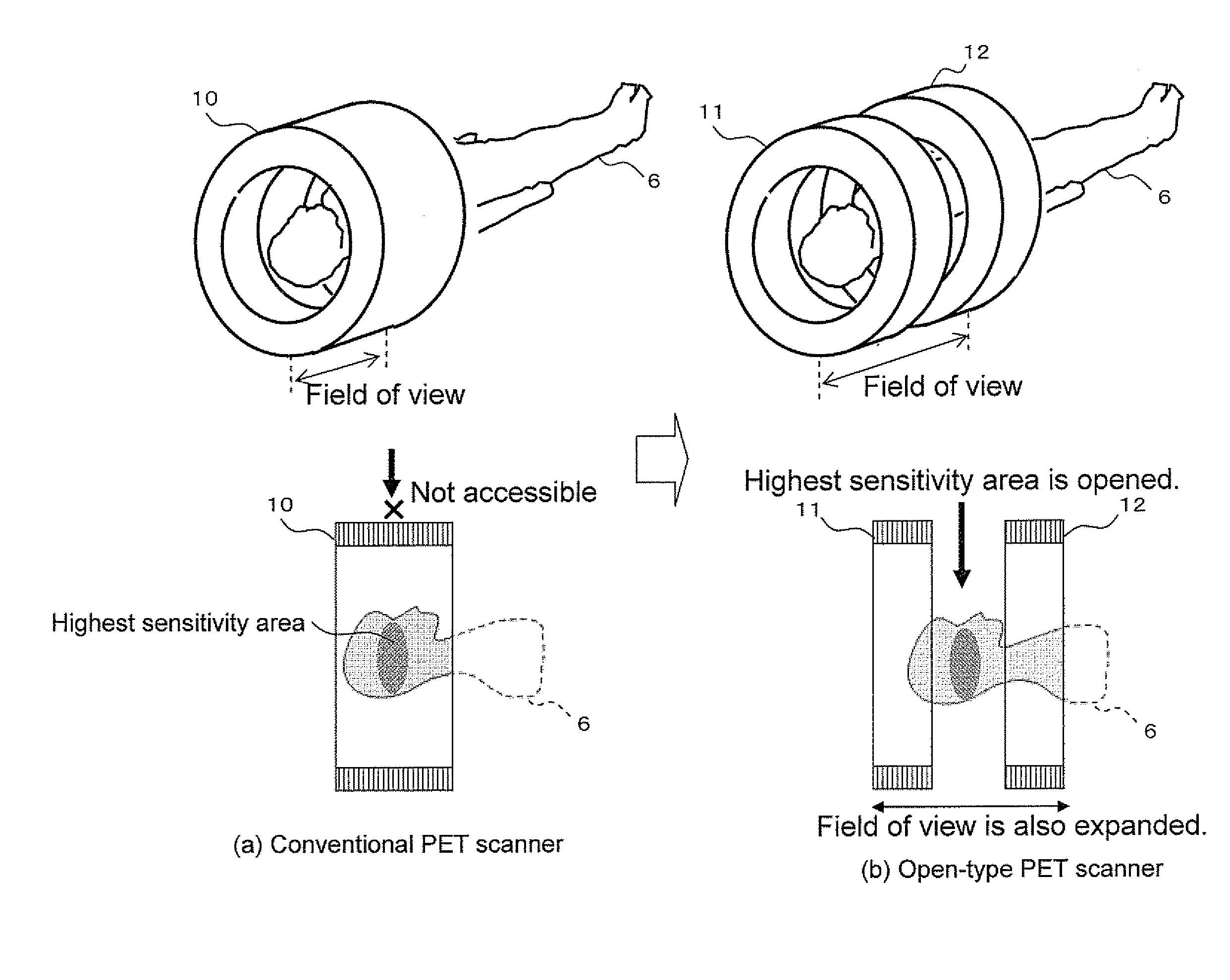 Detector-shift type combined radiation therapy/pet apparatus