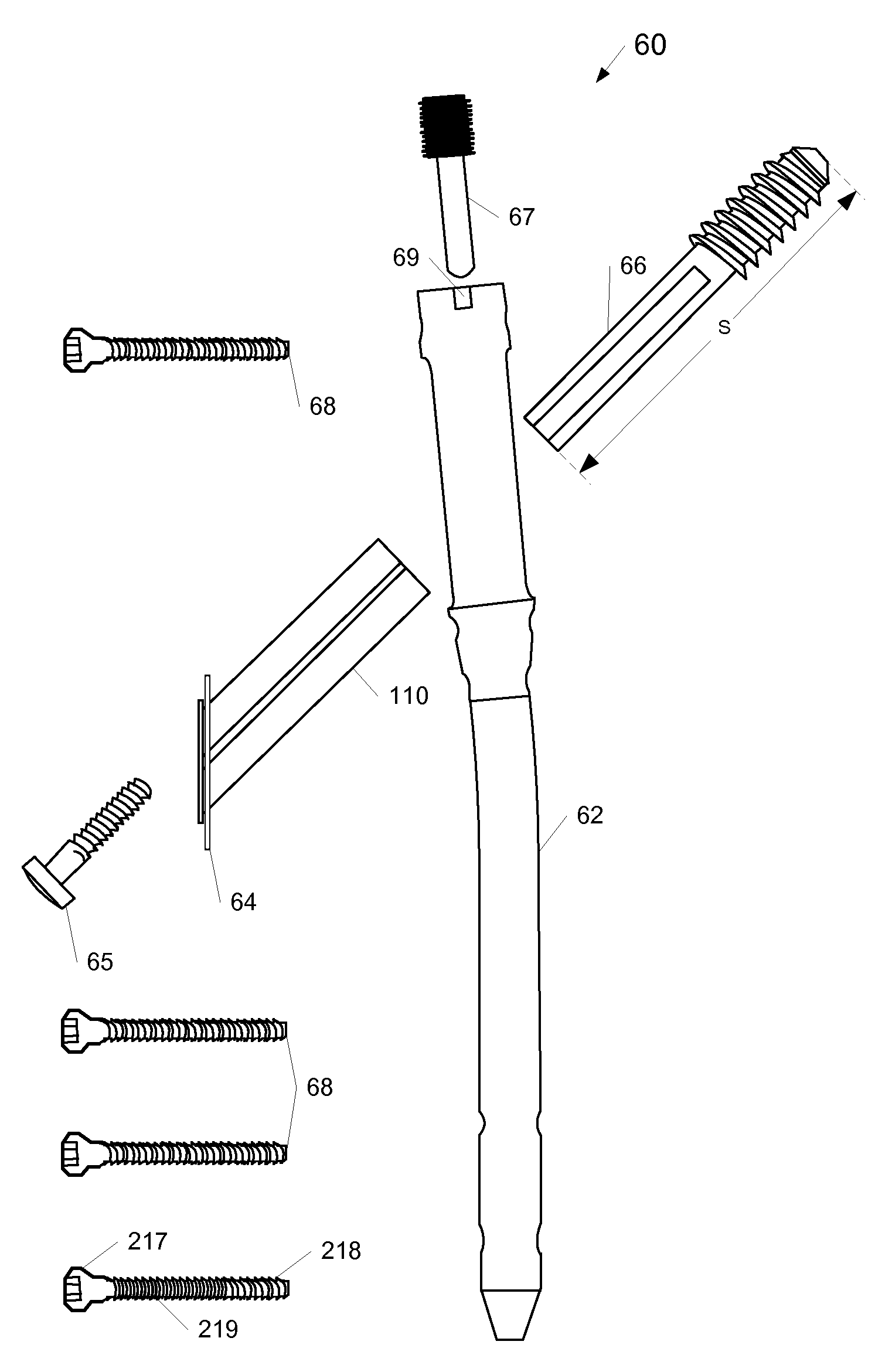 Femoral Universal Nail