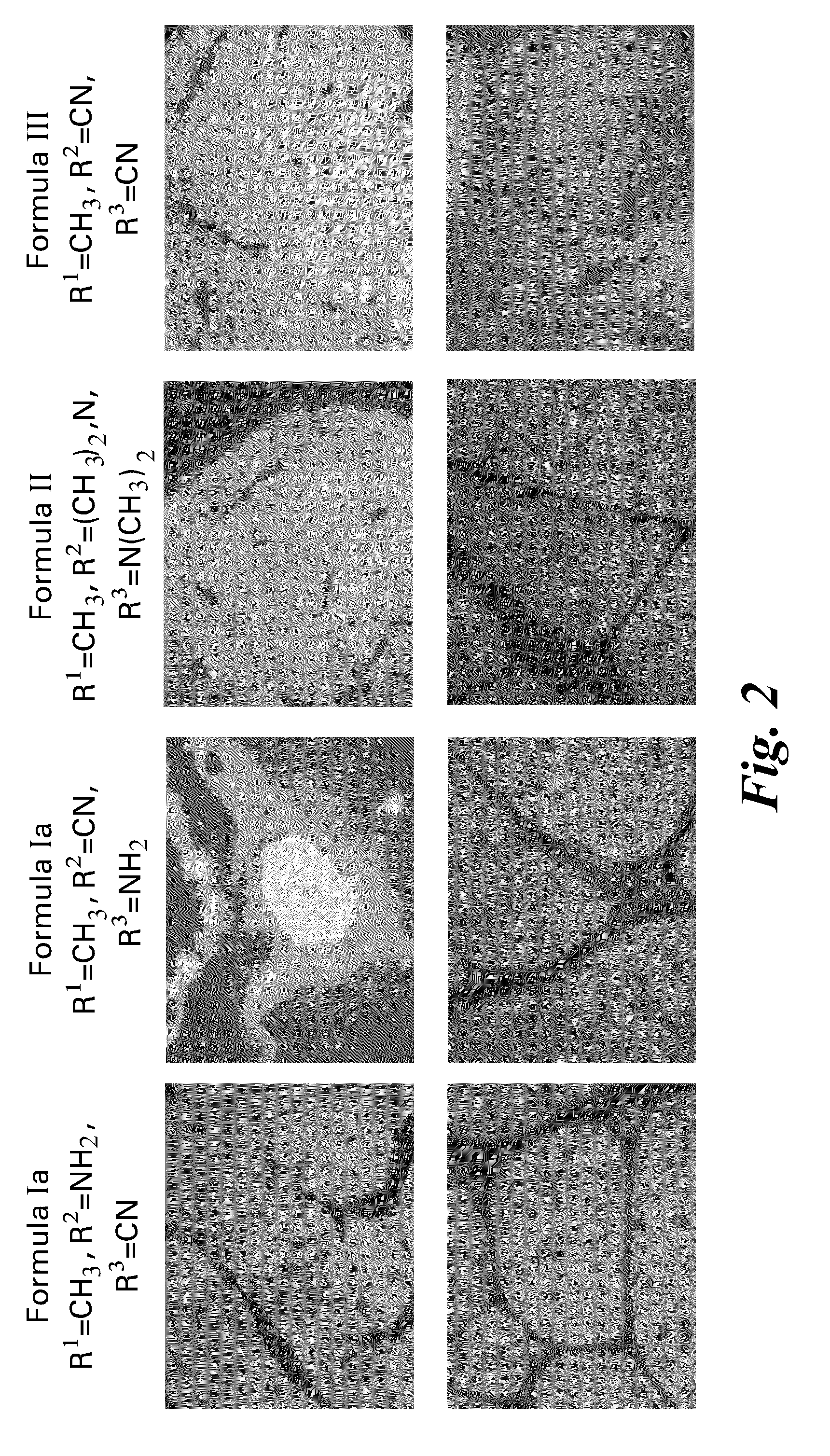 Imaging of myelin basic protein