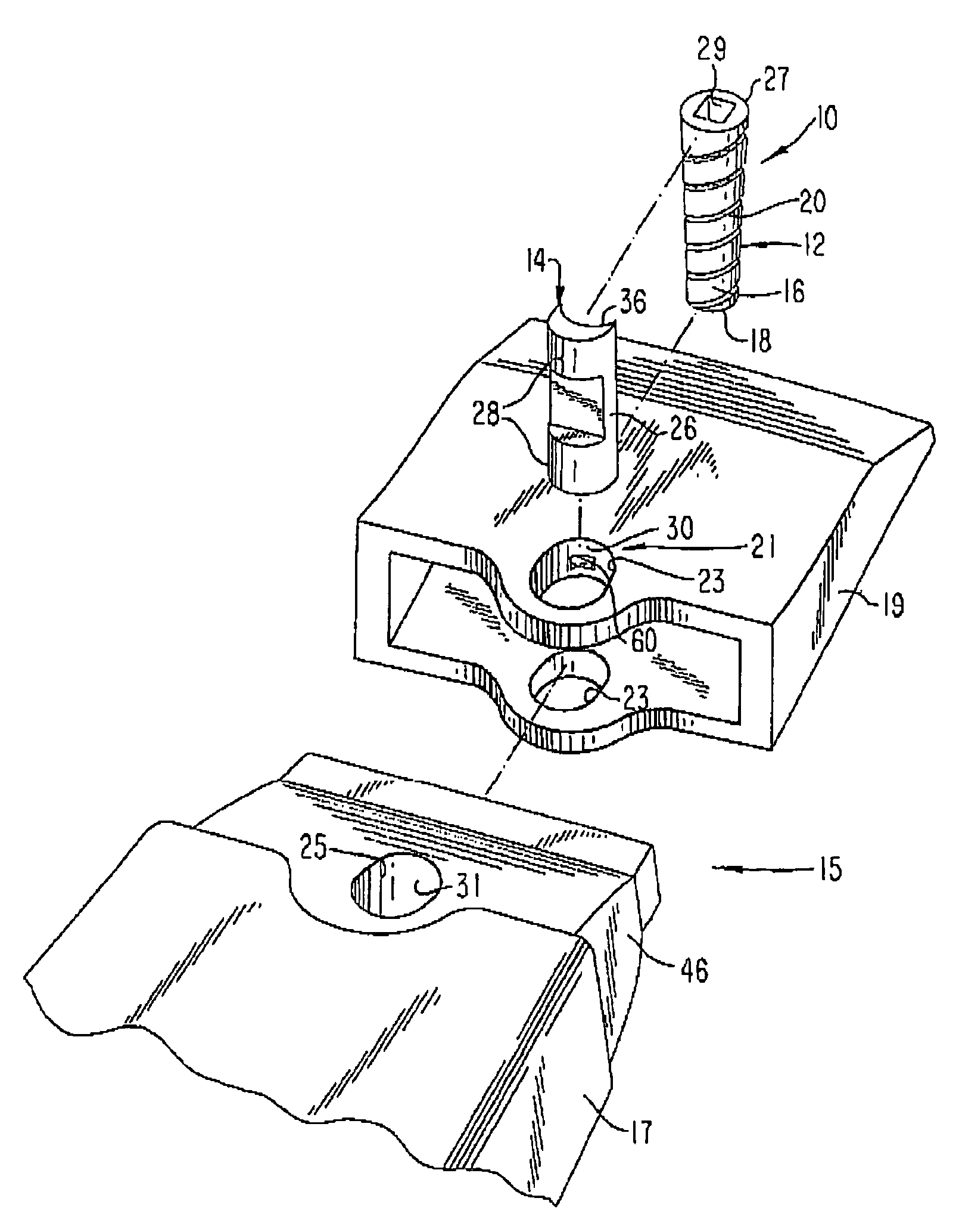 Releasable coupling assembly