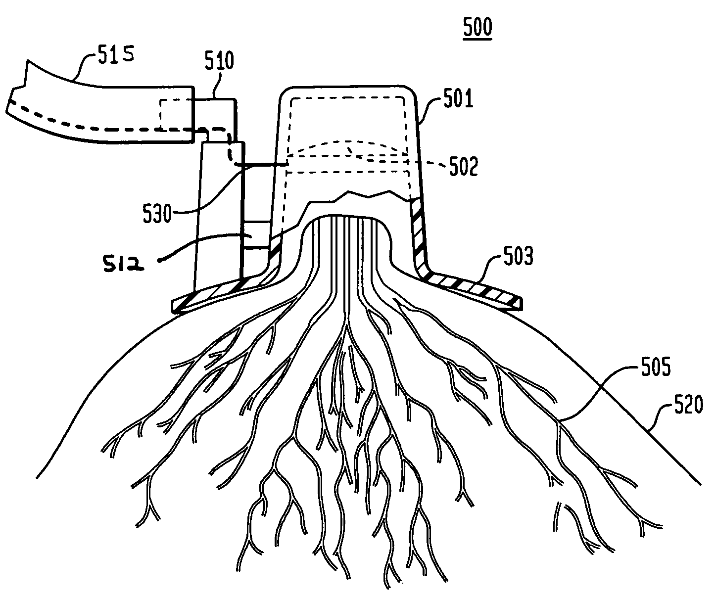 Method and system for detecting electrophysiological changes in pre-cancerous and cancerous breast tissue and epithelium