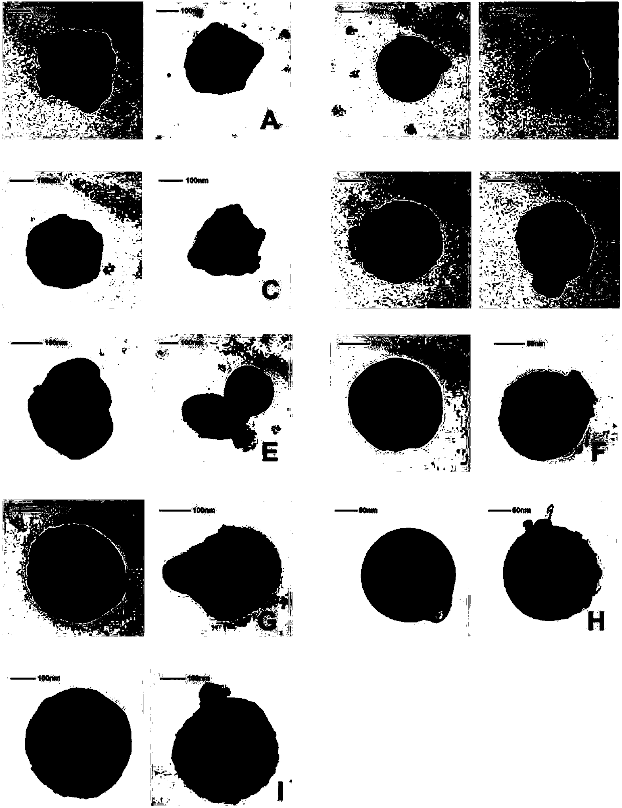 Intraocular drug delivery composition and preparation method thereof