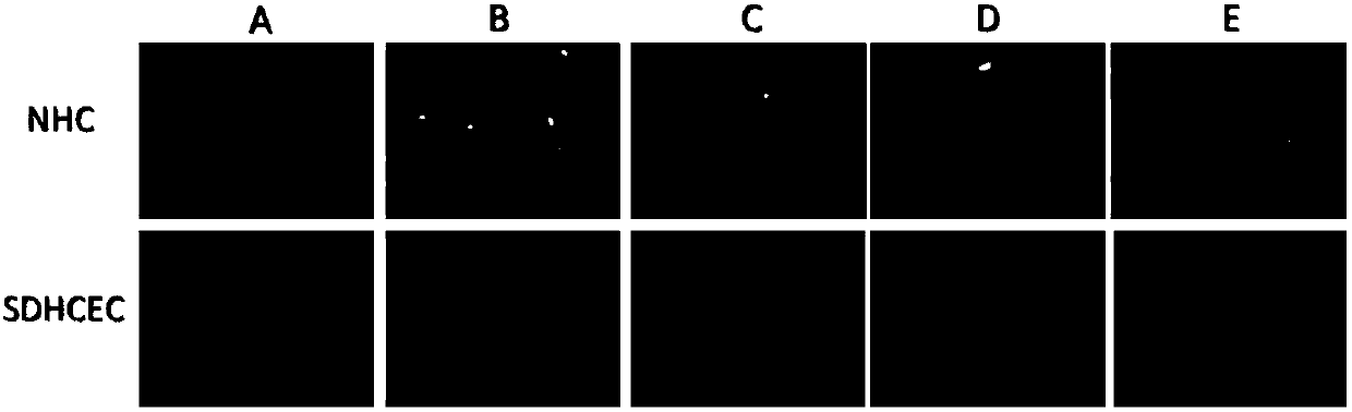 Intraocular drug delivery composition and preparation method thereof