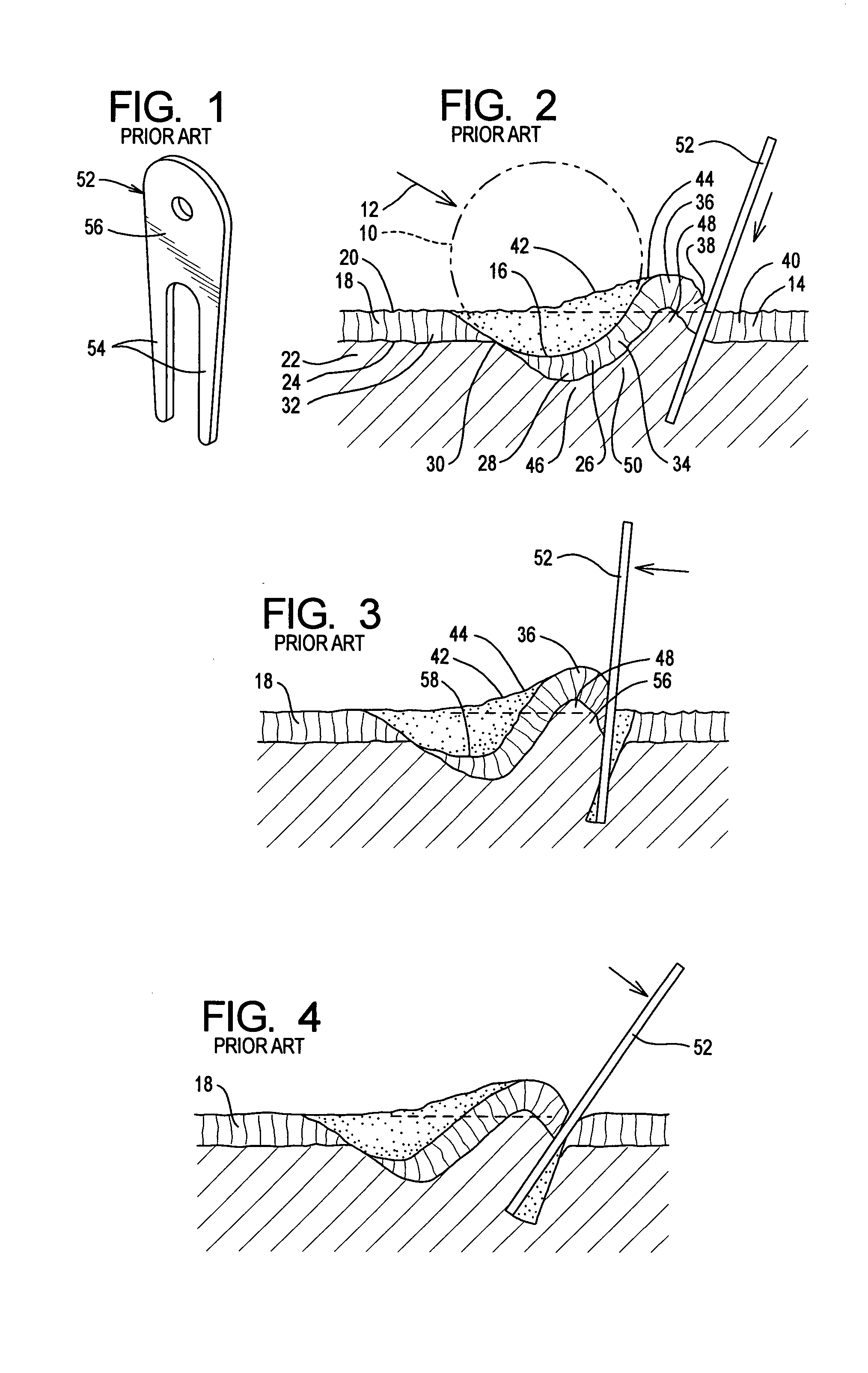 Golf green repair device method and apparatus