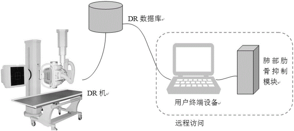 Image processing method for chest X-ray DR (digital radiography) image rib inhibition