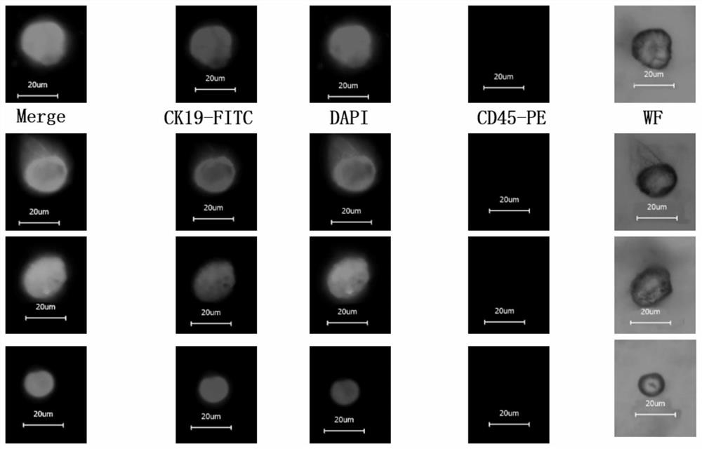 Integrated liquid-based tumor cell intelligent sorting device and control system