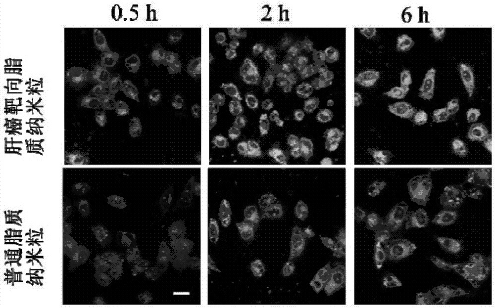 Hepatocarcinoma targeting lipid nanoparticle as well as preparation method and application