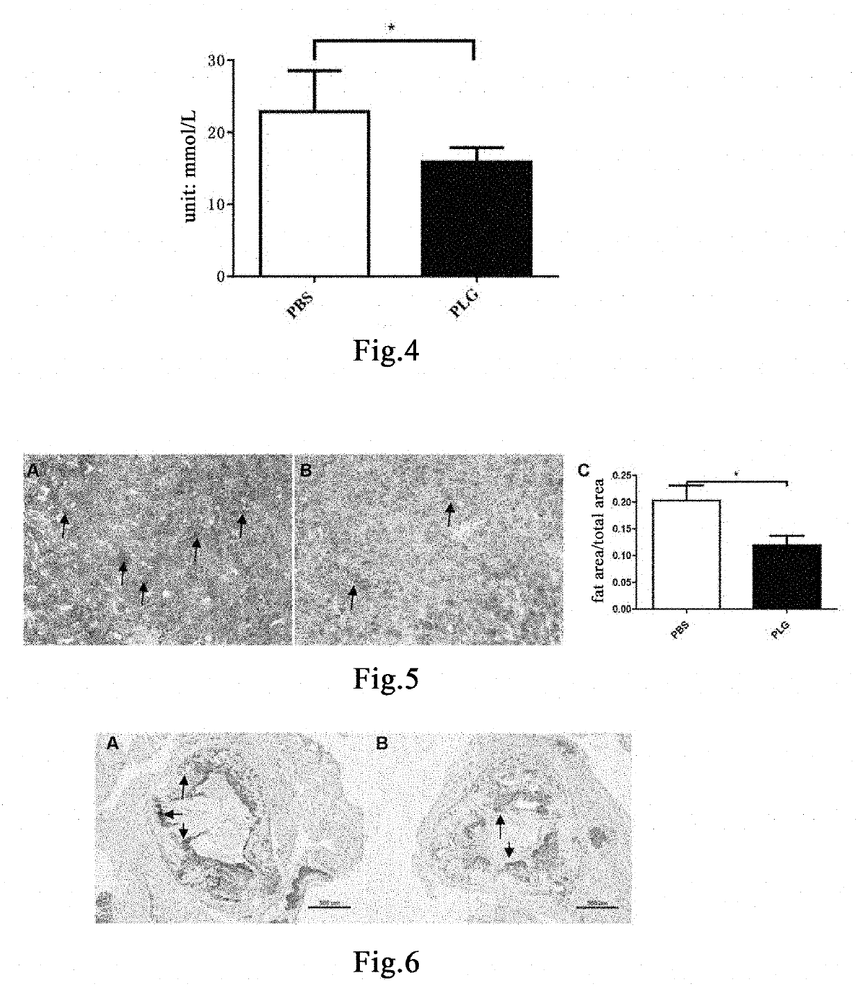 Method for treating and preventing atherosclerosis and complications thereof