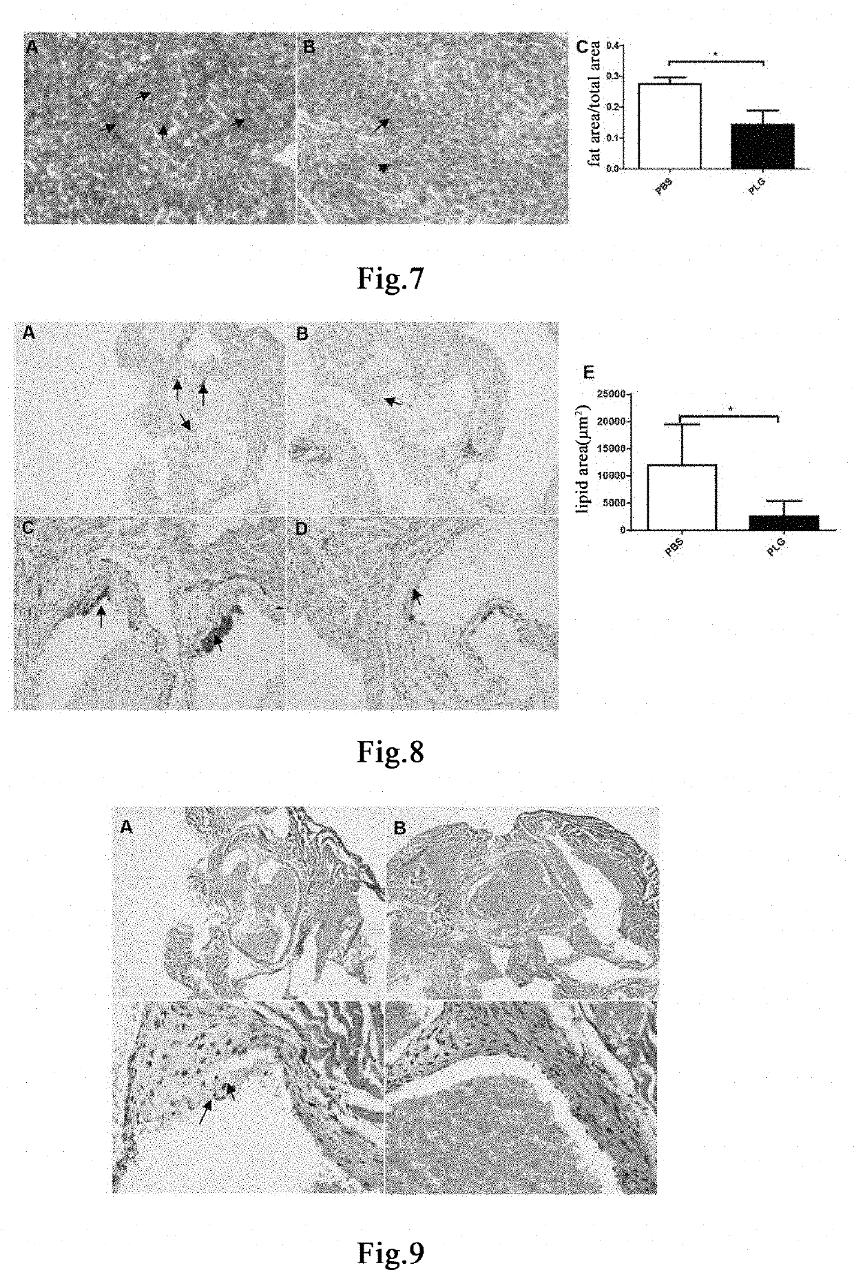 Method for treating and preventing atherosclerosis and complications thereof