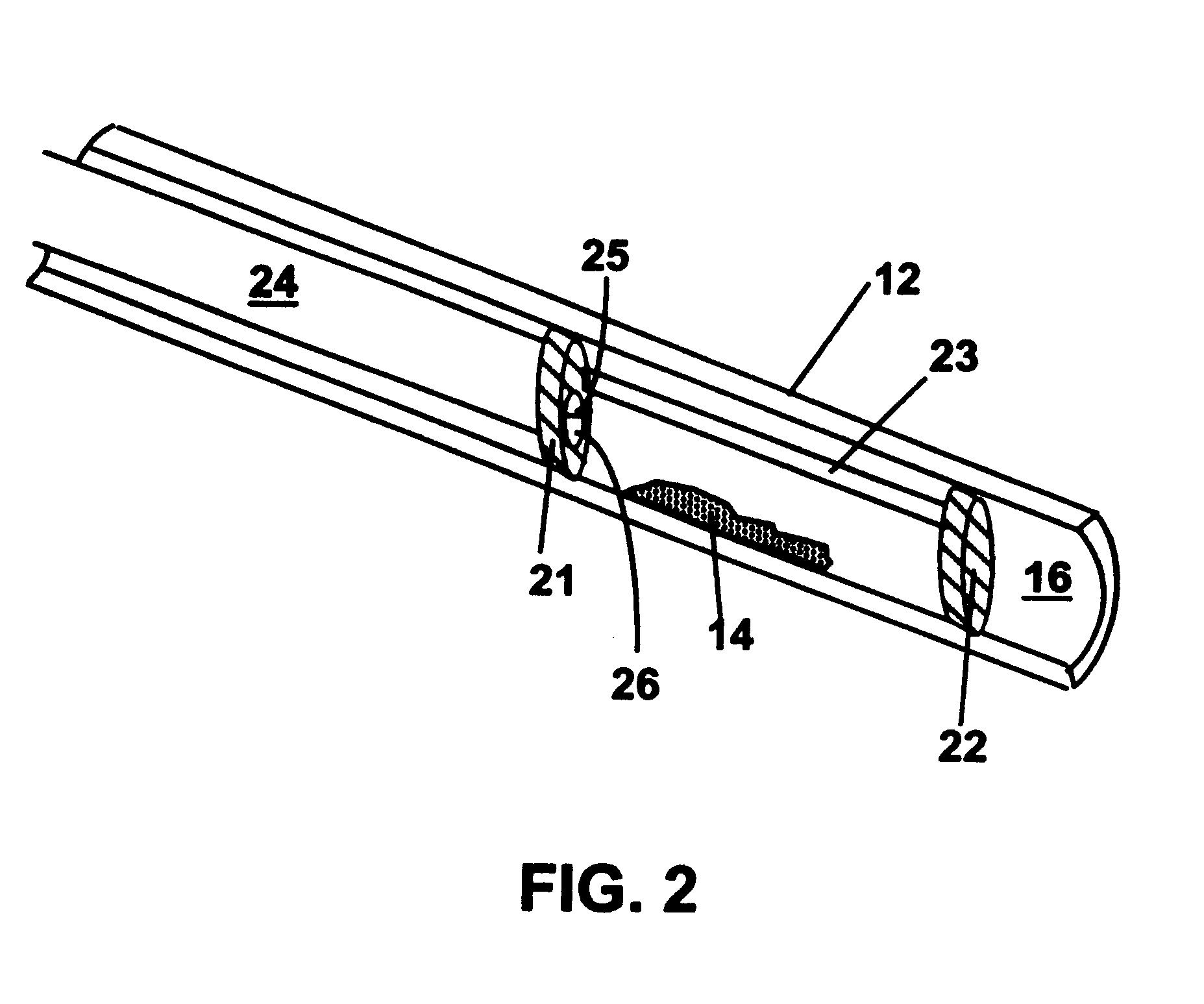 Kits for use in the treatment of vascular calcified lesions