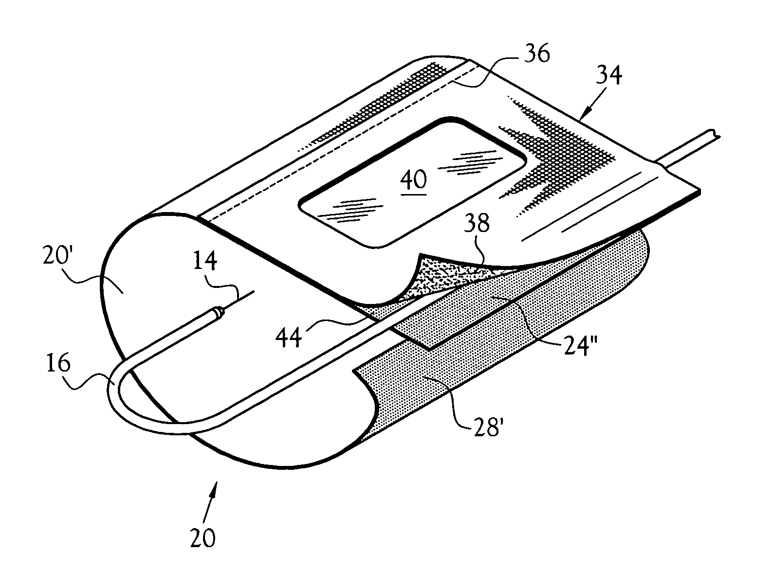 Intravascular infusion site anti-tamper guard having means for site inspection