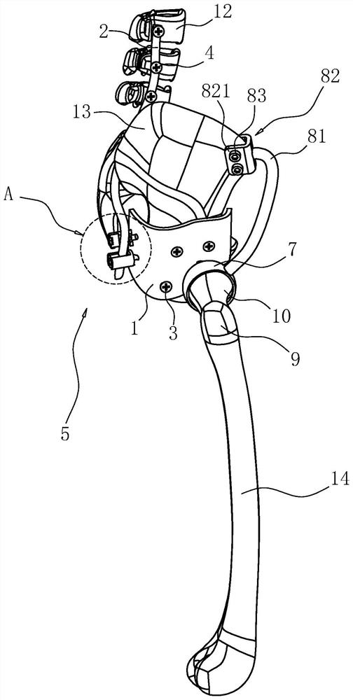 Fixing prosthesis for osteolysis therapy