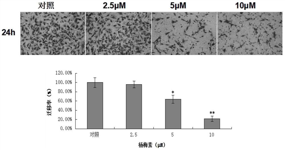 A kind of myricetin extract, the pharmaceutical composition containing it and its use